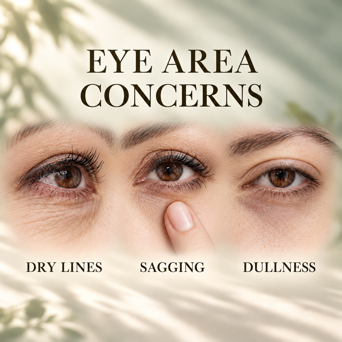 Common eye-area concerns